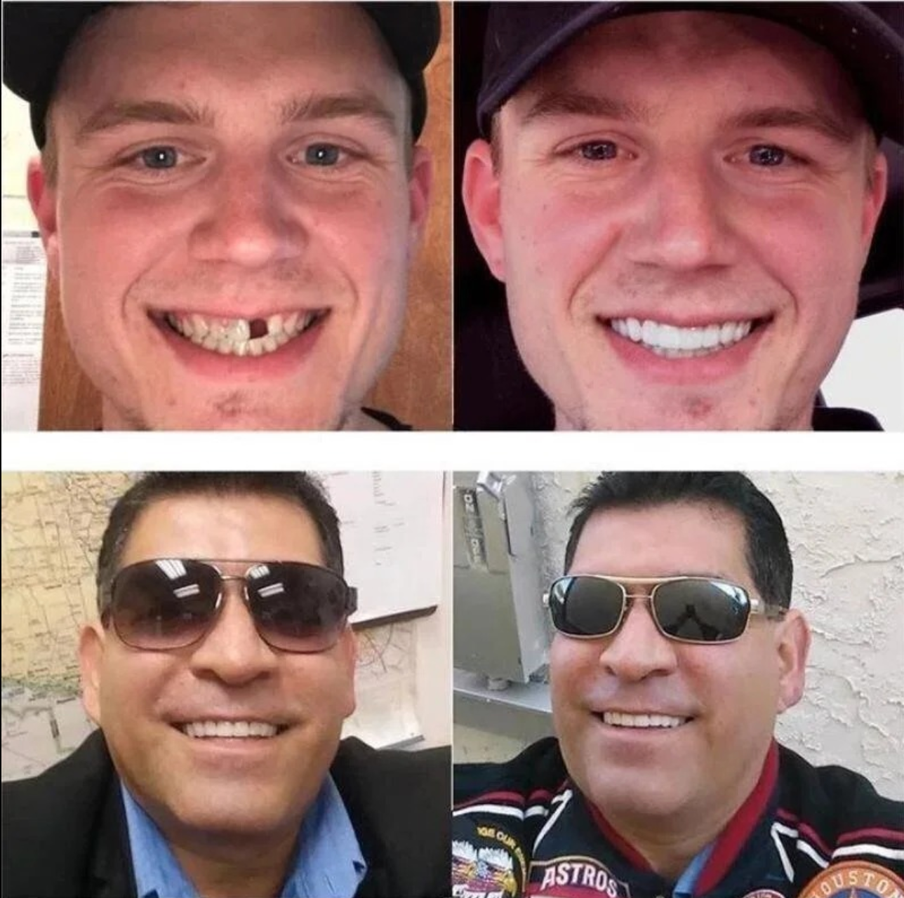 HaulWellGoods - Snap-On Dentures - Instant Confident Smile