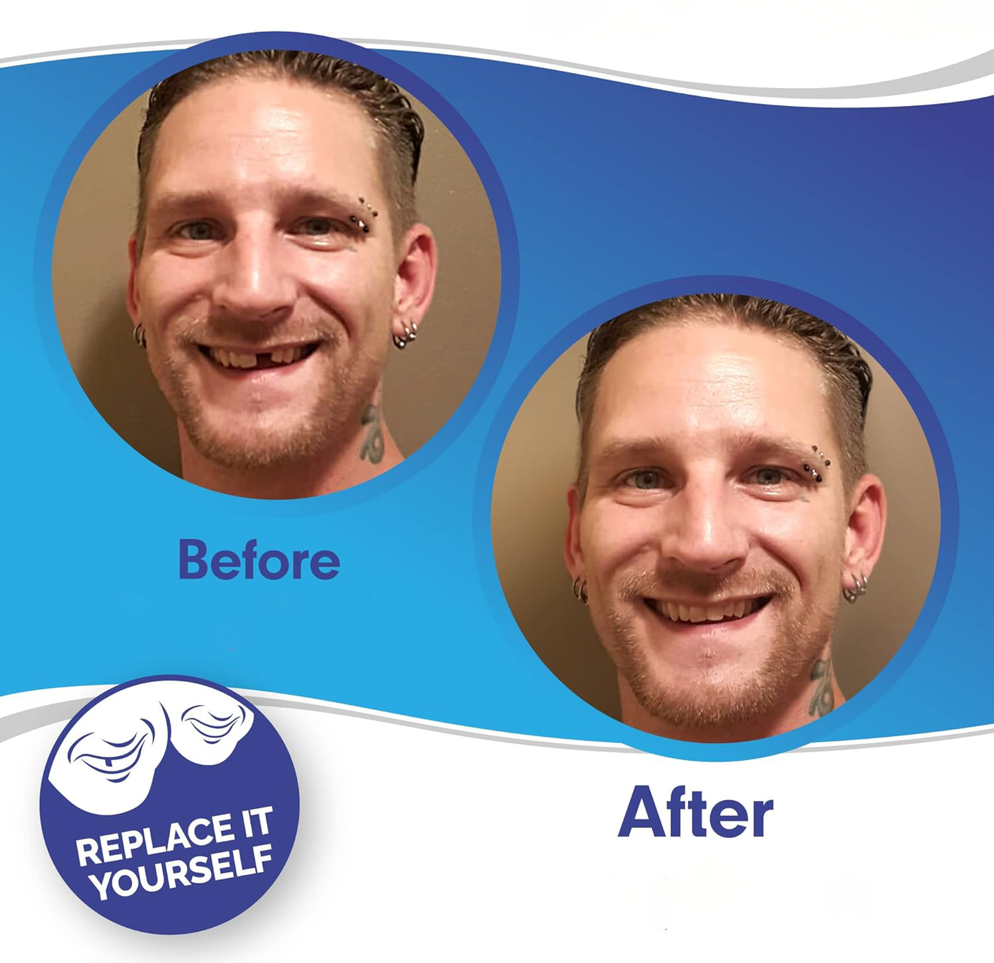 HaulWellGoods - Smile Veneers - Confident Smile Fast