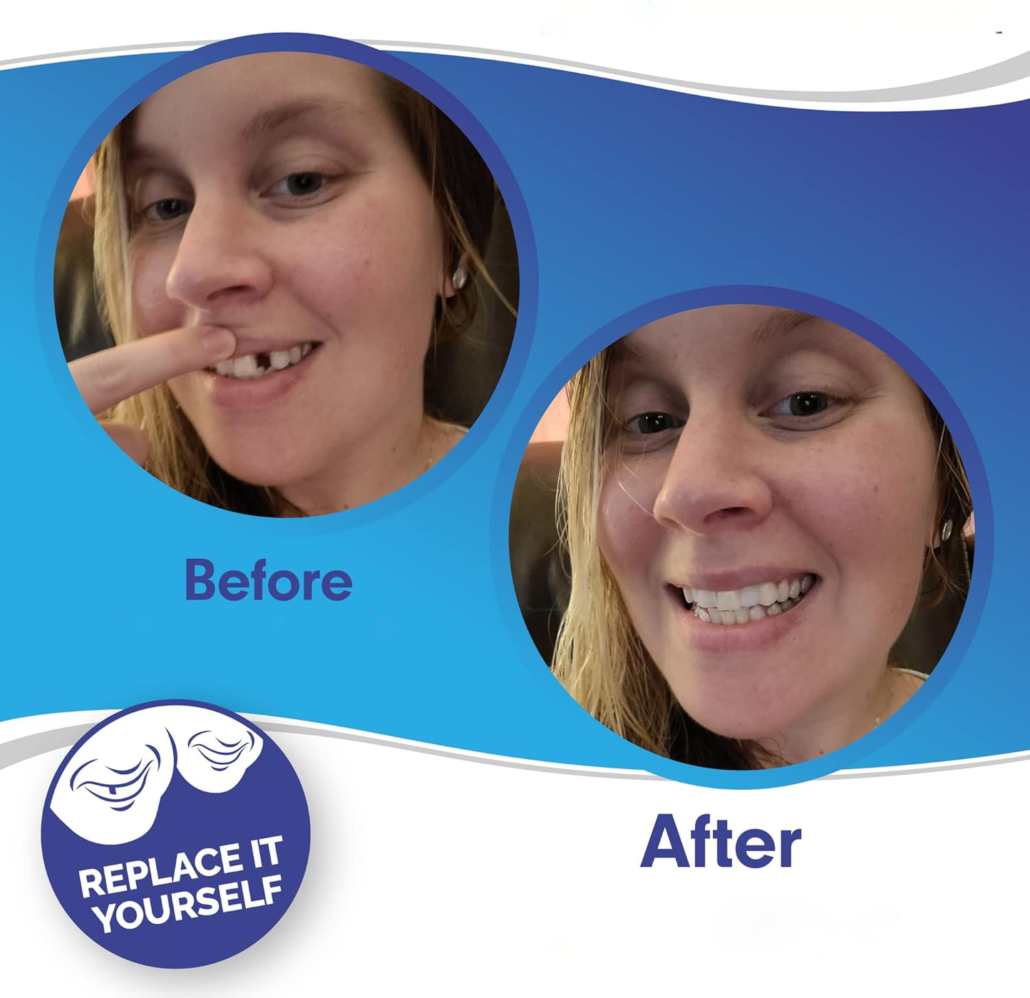 HaulWellGoods - Smile Veneers - Confident Smile Fast