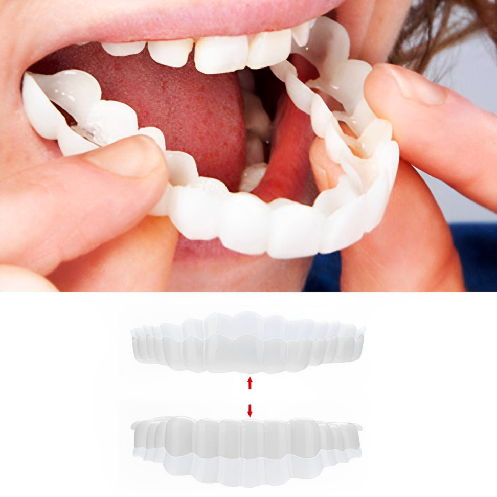 HaulWellGoods - Smile Veneers - Confident Smile Fast