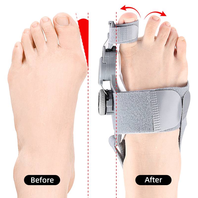 HaulWellGoods - Bunion Toe Spacer - Gentle Comfort