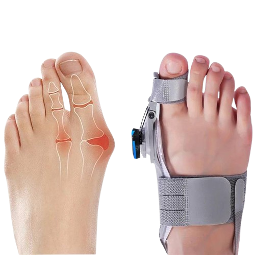 HaulWellGoods - Bunion Toe Spacer - Gentle Comfort