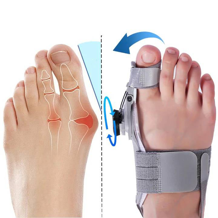 HaulWellGoods - Bunion Toe Spacer - Gentle Comfort