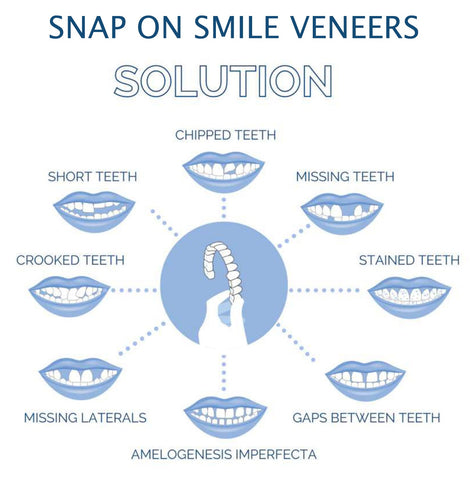 HaulWellGoods - Smile Veneers - Confident Smile Fast